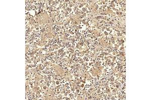 IHC analysis of RBMS1 using anti-RBMS1 antibody (ABIN7601195).