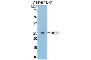 Western Blotting (WB) image for anti-Slit Homolog 3 (SLIT3) (AA 1348-1517) antibody (ABIN1860583) (SLIT3 抗体  (AA 1348-1517))