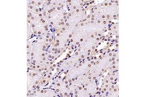 Immunohistochemistry (Paraffin-embedded Sections) (IHC (p)) image for anti-Ubiquitin Specific Peptidase 34 (USP34) antibody (ABIN7076115)