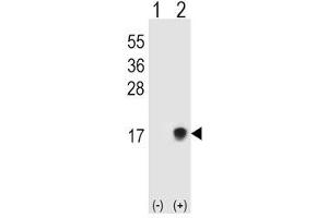 Western blot testing of SUMO2/3 antibody and 293T cell lysate either nontransfected (Lane 1) or transiently transfected (Lane 2) with the SUMO3 gene. (SUMO2/3 抗体  (AA 49-81))