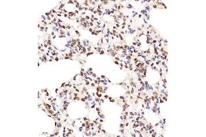 Immunohistochemistry of paraffin embedded rat lung using SHF-1 (ABIN7075710) at dilution of 1:600 (400x lens) (SHF 抗体)