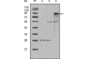 Western blot analysis using MPO mouse mAb against truncated Trx-MPO recombinant protein (1),truncated MBP-MPO (aa1-193) recombinant protein (2) and truncated MPO(aa165-745)-hIgGFc transfected CHO-K1 cell lysate(3). (Myeloperoxidase 抗体  (AA 1-193))