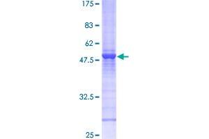 RAB6A Protein (AA 1-208) (GST tag)