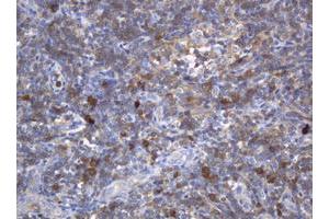 Image no. 1 for anti-Mast/stem Cell Growth Factor Receptor (KIT) (AA 546-976) antibody (ABIN1491585) (KIT 抗体  (AA 546-976))