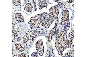 IHC analysis of HDAC2 using anti-HDAC2 antibody (ABIN7601564). (HDAC2 抗体  (AA 387-488))