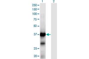 Western Blot analysis of XPA expression in transfected 293T cell line by XPA monoclonal antibody (M01), clone 2E4. (XPA 抗体  (AA 1-273))