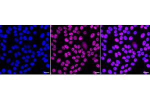 Immunocytochemical staining of HepG2 cells with MBD2 antibody (ABIN7799386), 1:1,000). (Recombinant MBD2 抗体)