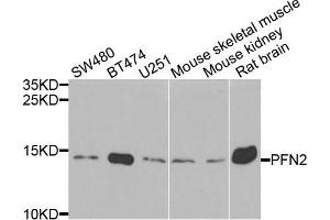 Western blot analysis of extracts of various cells, using PFN2 antibody. (PFN2 抗体)
