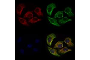 ABIN6263750 and ABIN6277026 staining Hela cells by IF/ICC. (CD73 抗体  (N-Term))