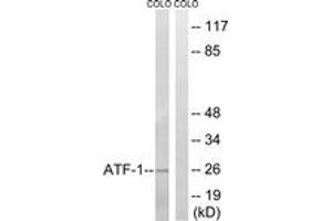 Western blot analysis of extracts from COLO cells, using ATF1 (Ab-63) Antibody. (AFT1 抗体  (AA 31-80))