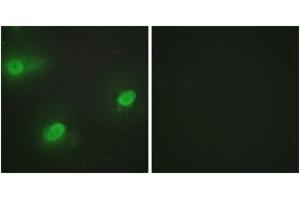 Immunofluorescence analysis of HeLa cells, using CSTF2 Antibody. (CSTF2 抗体  (AA 11-60))