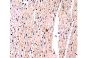 Used in DAB staining on fromalin fixed paraffin- embedded heart tissue (PIM1 抗体  (AA 122-261))