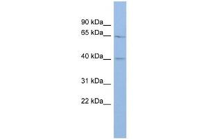 MLC1 antibody used at 1 ug/ml to detect target protein. (MLC1 抗体  (Middle Region))