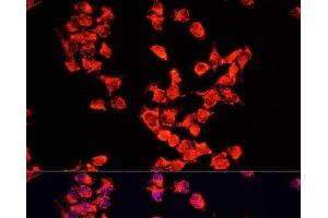 Immunofluorescence analysis of HeLa cells using FXR1 Polyclonal Antibody at dilution of 1:100. (FXR1 抗体)