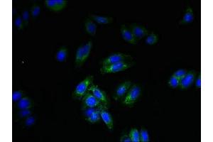 Immunofluorescent analysis of HepG2 cells using ABIN7168900 at dilution of 1:100 and Alexa Fluor 488-congugated AffiniPure Goat Anti-Rabbit IgG(H+L) (SPTLC3 抗体  (AA 1-58))