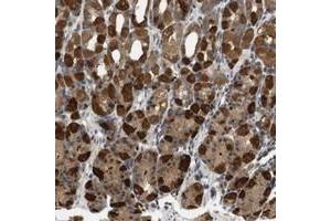 Immunohistochemical staining of human stomach with TXNDC10 polyclonal antibody  shows strong cytoplasmic positivity in glandular cells.