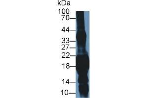 Western Blot; Sample: Mouse Eye lysate; Primary Ab: 1µg/ml Rabbit Anti-Mouse CRYgS Antibody Second Ab: 0.