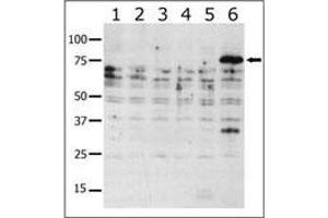 Western blot analysis of anti-K6 b (ABIN392439 and ABIN2842037) in lysates from transiently transfected COS7 cells. (PAK6 抗体  (AA 116-146))