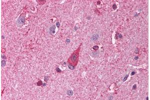 Human Brain, Cortex (formalin-fixed, paraffin-embedded) stained with TLR8 antibody ABIN214003 at 5 ug/ml followed by biotinylated goat anti-rabbit IgG secondary antibody ABIN481713, alkaline phosphatase-streptavidin and chromogen. (TLR8 抗体)