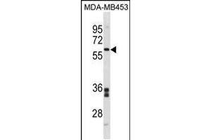 Western blot analysis in MDA-MB453 cell line lysates (35ug/lane). (FMO5 抗体  (C-Term))
