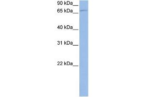 WB Suggested Anti-TBK1 Antibody Titration: 0. (TBK1 抗体  (N-Term))