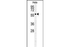 Western blot analysis in Hela cell line lysates (35ug/lane). (GALNT4 抗体  (N-Term))