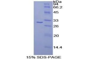 SDS-PAGE analysis of Human CELSR2 Protein. (CELSR2 蛋白)