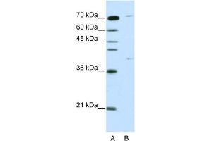 WB Suggested Anti-ZNF668 Antibody Titration:  1. (ZNF668 抗体  (C-Term))