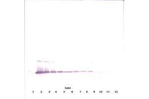 Image no. 1 for anti-Interleukin 17A (IL17A) antibody (ABIN465354) (Interleukin 17a 抗体)