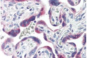 Immunohistochemistry (Paraffin-embedded Sections) (IHC (p)) image for anti-Cytochrome P450, Family 26, Subfamily A, Polypeptide 1 (CYP26A1) (C-Term) antibody (ABIN364310)