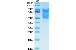 Human Syndecan-1 on Tris-Bis PAGE under reduced condition. (Syndecan 1 Protein (SDC1) (AA 23-254) (His tag))