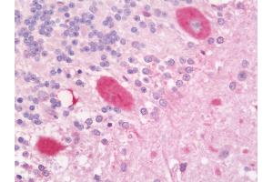 Immunohistochemistry (IHC) image for anti-Coronin, Actin Binding Protein, 1B (CORO1B) (AA 450-489) antibody (ABIN2619463)