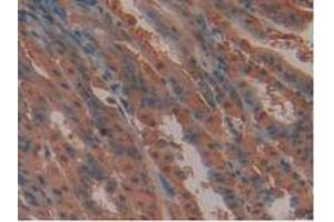IHC-P analysis of Mouse Stomach Tissue, with DAB staining. (FLT4 抗体  (AA 30-326))