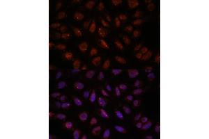 Immunofluorescence analysis of U-2 OS cells using DDX24 antibody (ABIN7266691) at dilution of 1:100. (DDX24 抗体  (AA 510-859))