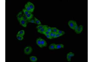 Immunofluorescence staining of HepG2 cells with ABIN7162742 at 1:166, counter-stained with DAPI. (SLC26A4 抗体  (AA 592-655))