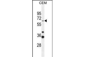 ZN Antibody (Center) (ABIN654509 and ABIN2844236) western blot analysis in CEM cell line lysates (35 μg/lane). (ZNF667 抗体  (AA 303-331))