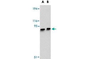 Western blot analysis of MACC1 in mouse liver tissue lysate with MACC1 polyclonal antibody  at (A) 1 and (B) 2 ug/mL . (MACC1 抗体  (Internal Region))