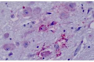 Anti-PPYR1 antibody IHC staining of human brain, hypothalamus. (NPY4R 抗体  (Cytoplasmic Domain))