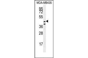 Western blot analysis in MDA-MB435 cell line lysates (35 µg/lane) using SAMD7 Antibody (Center) Cat. (SAMD7 抗体  (Middle Region))