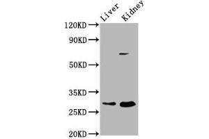 Western Blot Positive WB detected in: Rat liver tissue, Rat kidney tissue All lanes: PEX11A antibody at 2. (PEX11A 抗体  (AA 106-219))