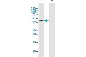 Western Blot analysis of SNUPN expression in transfected 293T cell line by SNUPN MaxPab polyclonal antibody. (Snurportin 1 抗体  (AA 1-360))