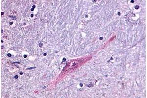 Immunohistochemical (Formalin/PFA-fixed paraffin-embedded sections) staining in human brain, putamen with GPR55 polyclonal antibody . (GPR55 抗体  (C-Term))