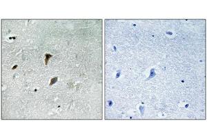 Immunohistochemistry (IHC) image for anti-Mitogen-Activated Protein Kinase Kinase 3 (MAP2K3) (pThr222) antibody (ABIN7138807)