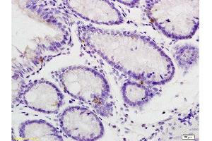 Formalin-fixed and paraffin embedded rat colitis labeled with Rabbit Anti phospho-IL-1R1(Tyr496)Polyclonal Antibody, Unconjugated  at 1:200 followed by conjugation to the secondary antibody and DAB staining (IL1R1 抗体  (pTyr496))