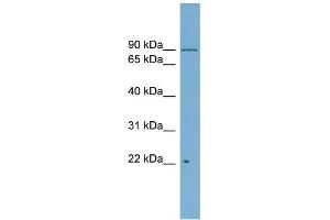 WB Suggested Anti-C12orf11 Antibody Titration: 0. (C12orf11 抗体  (Middle Region))
