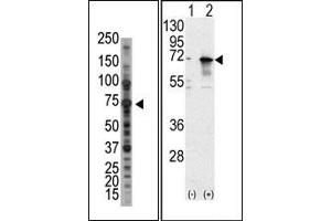 Image no. 1 for anti-Protein Inhibitor of Activated STAT, 1 (PIAS1) (N-Term) antibody (ABIN5552003) (PIAS1 抗体  (N-Term))