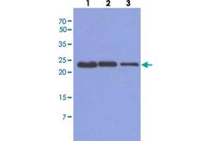 Western blot analysis of Mouse muscle extract (40 ug) by using TNNI1 monoclonal antibody, clone AT36E7  (1:500-1:5000). (TNNI1 抗体  (AA 1-187))