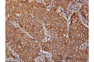 Immunostaining (ISt) image for anti-Major Vault Protein (MVP) (AA 1-893) antibody (ABIN564285)