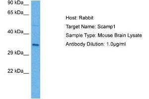 Host: Rabbit Target Name: SCAMP1 Sample Tissue: Mouse Brain Antibody Dilution: 1ug/ml (SCAMP1 抗体  (N-Term))