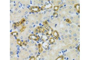 Immunohistochemistry of paraffin-embedded Mouse kidney using PHPT1 Polyclonal Antibody at dilution of 1:100 (40x lens). (PHPT1 抗体)